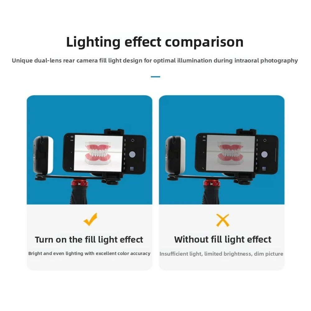 Luz de fotografía dental, flas - Photography Lighting With Flash reseña y precio